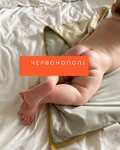 КРАСНОПОПЫЕ